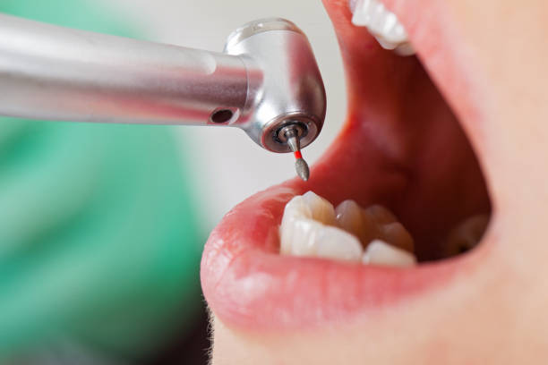 Best Emergency Gum Treatment in Streamwood, IL